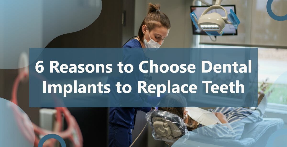 Reasons Why to Choose Dental Implants to Replace Teeth